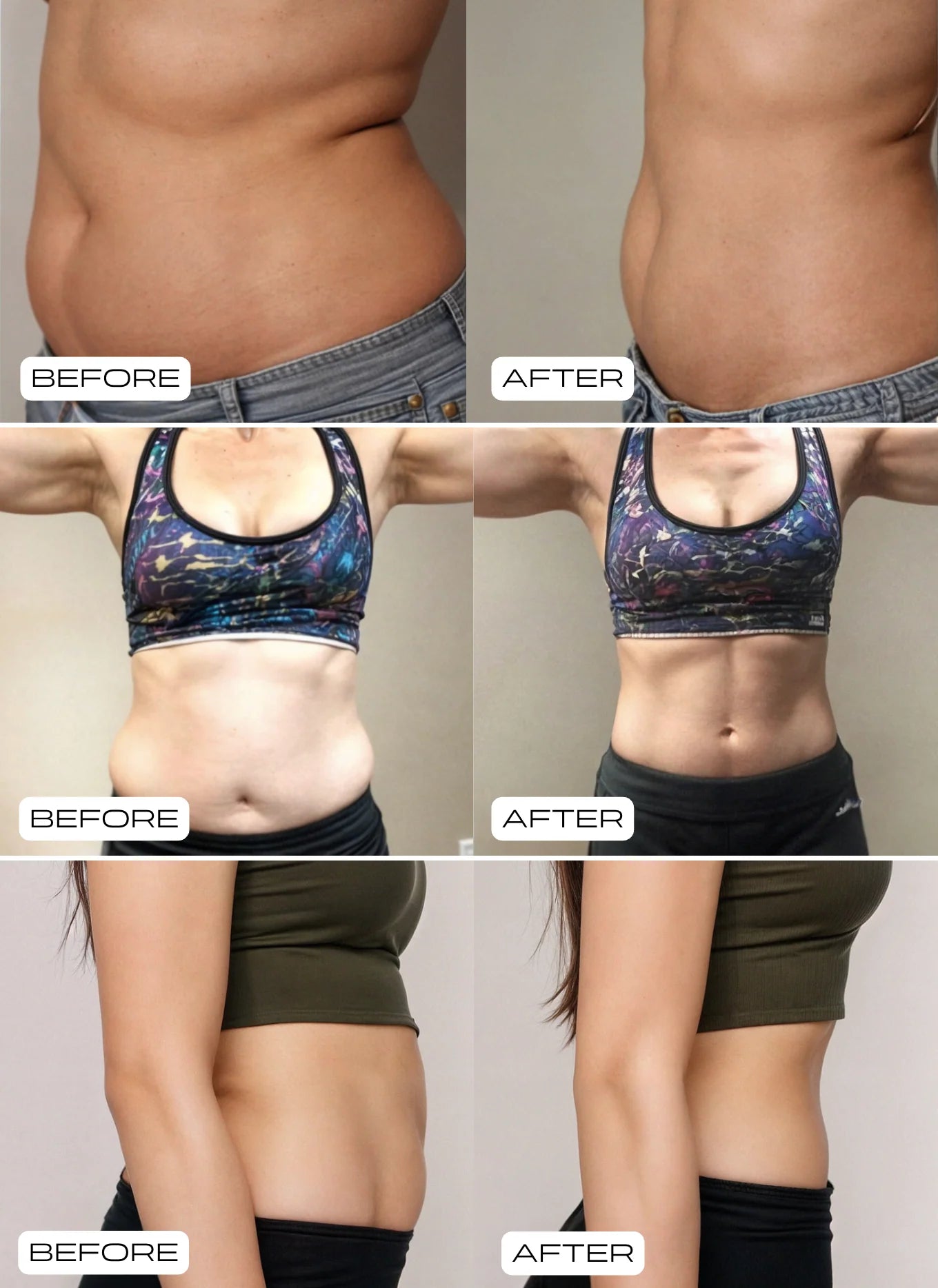 Pilates Reformer Seti