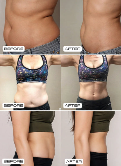 Pilates Reformer Seti