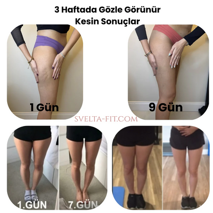 Svelta--Fit™ Bacak İncelten Sıkılaştıran Masaj Aleti